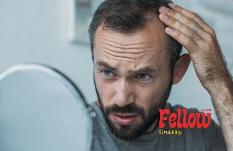 Hair loss is a problem that must be solved quickly