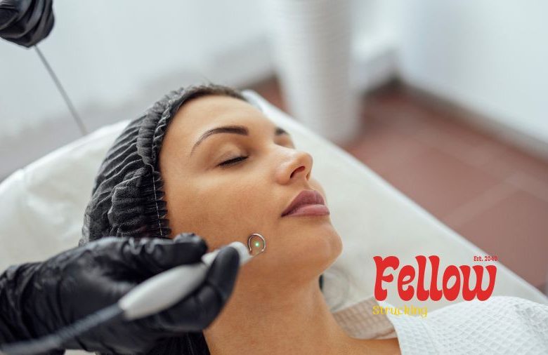 Laser treatment for acne scars